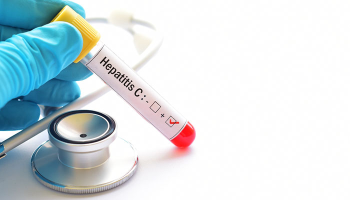 Bệnh viêm gan C