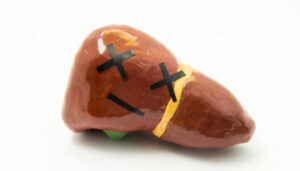 Viêm gan nhiễm độc